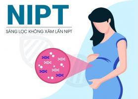 Địa chỉ xét nghiệm NIPT tốt nhất Đồng Nai