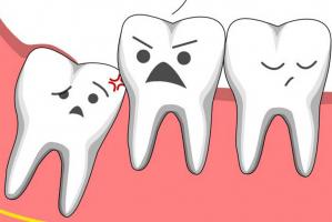 Nha khoa nhổ răng khôn uy tín tại TP. HCM