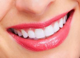Sản phẩm giúp tẩy trắng răng, cho bạn nụ cười trắng sáng tốt nhất