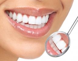 Thói quen gây hại cho răng của bạn