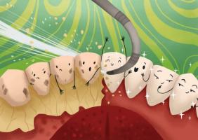 Phương pháp tự nhiên giúp loại bỏ các mảng bám trên răng hiệu quả nhất