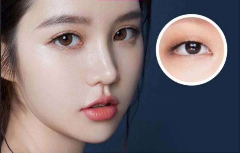 Top 8 Địa chỉ nhấn mí đẹp và an toàn nhất tỉnh Thanh Hóa
