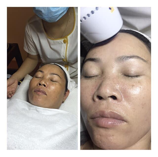 Annona Beauty Spa Đồng Xoài