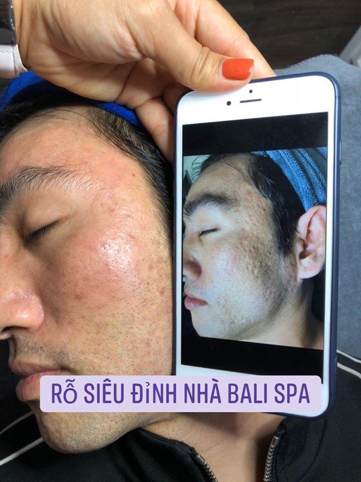 Bali Spa & Clinic