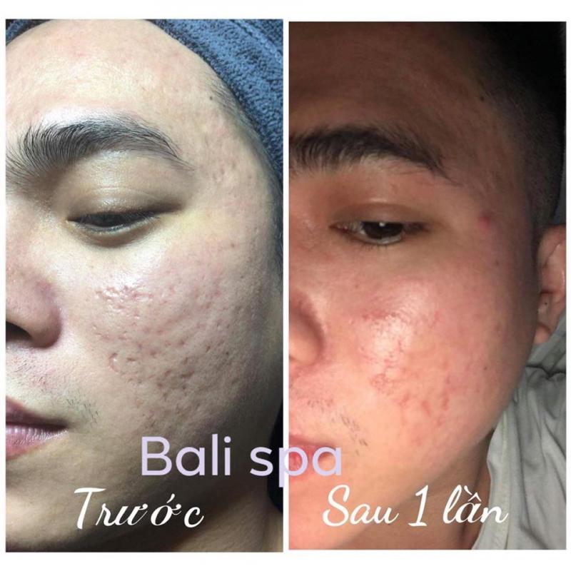 Bali Spa & Clinic