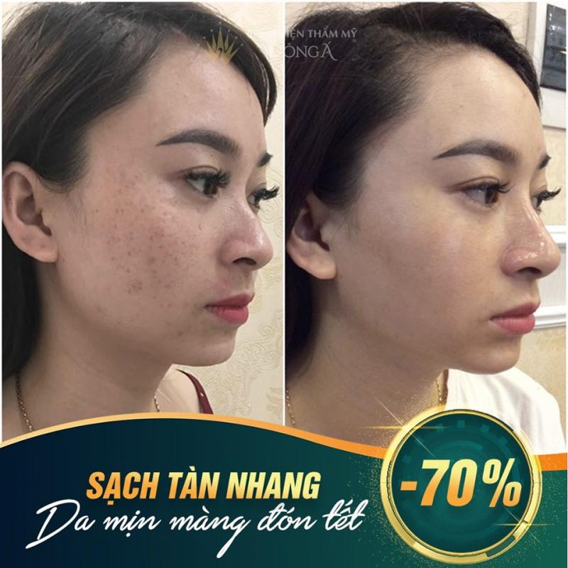 Bệnh Viện Thẩm Mỹ Đông Á