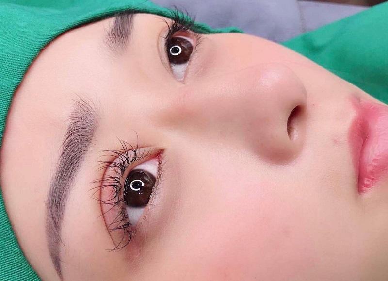 Top 7 Địa chỉ cắt mí đẹp và an toàn nhất tỉnh Gia Lai