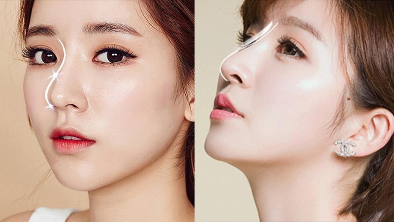 Top 9 Địa chỉ nâng mũi đẹp và an toàn nhất Đà Nẵng
