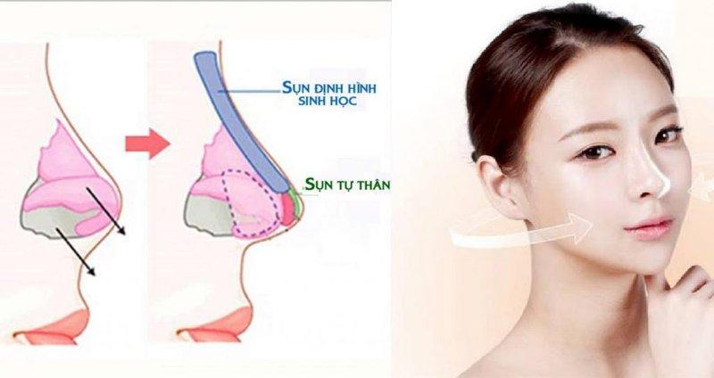 Top 7 Địa chỉ nâng mũi đẹp và an toàn nhất tỉnh Khánh Hòa