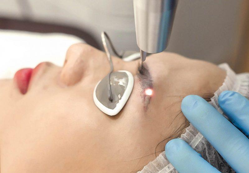Top 8 Địa chỉ xóa xăm chân mày uy tín và hiệu quả nhất TP. HCM