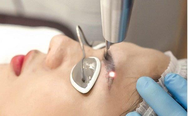 Top 7 Địa chỉ xoá xăm lông mày tại Đà Nẵng uy tín nhất