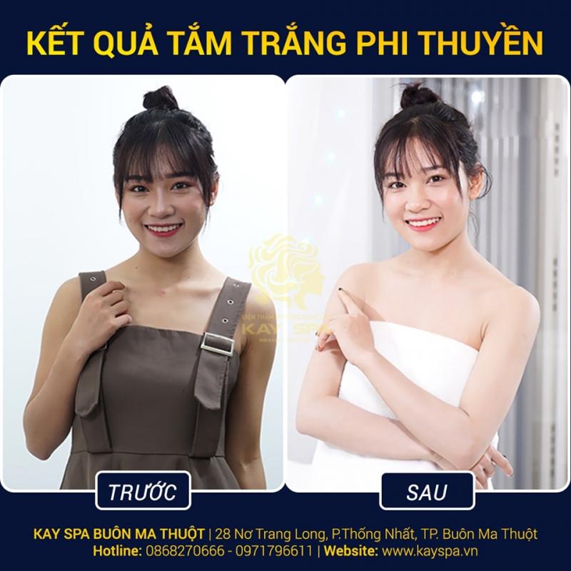 Kay Spa - Thẩm Mỹ Công Nghệ Cao