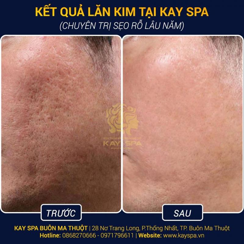 Kay Spa - Thẩm Mỹ Công Nghệ Cao Buôn Ma Thuột