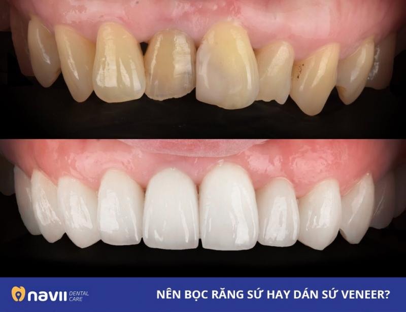 Navii Dental Care