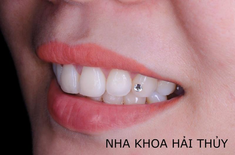 Nha Khoa HẢI THỦY