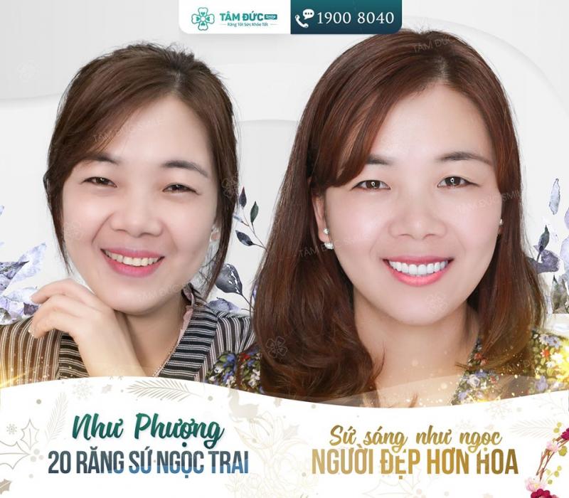 Nha khoa Tâm Đức Smile