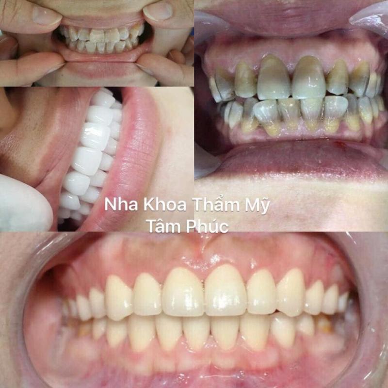 Nha Khoa Thẩm Mĩ Tâm Phúc