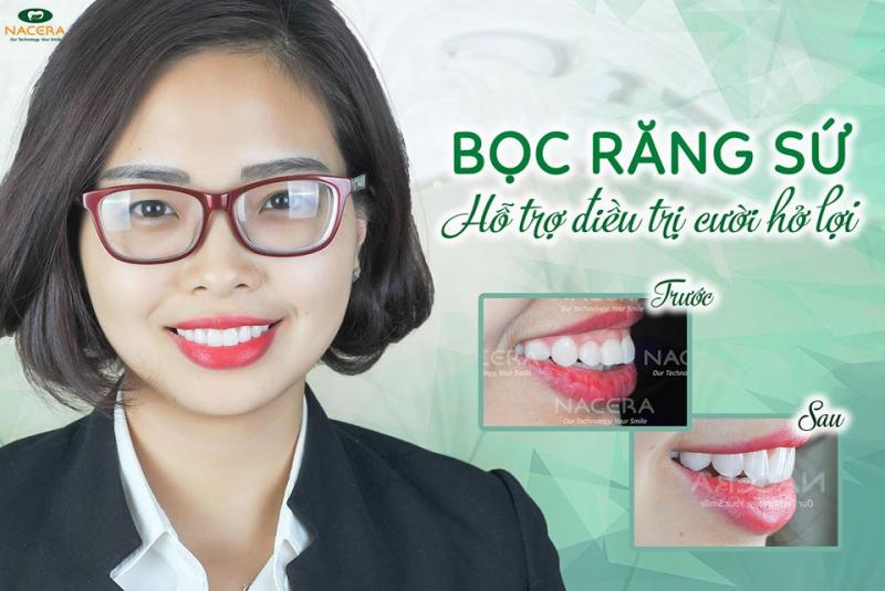 Nha khoa Thẩm Mỹ Quốc Tế Nacera