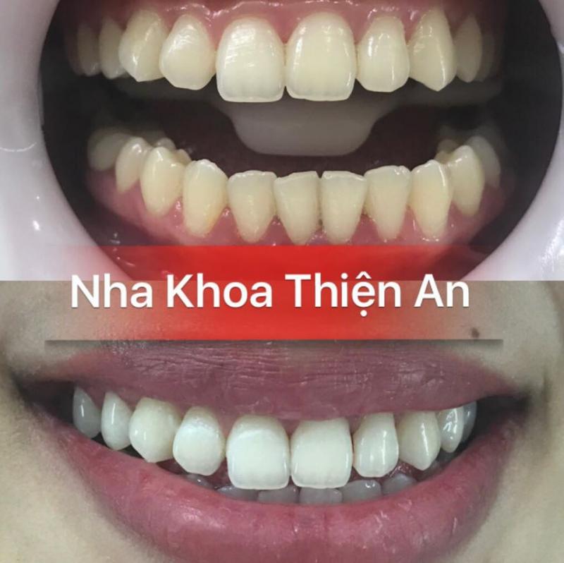 Nha Khoa Thiện An