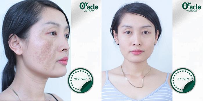 Oracle Beauty Clinic Vietnam