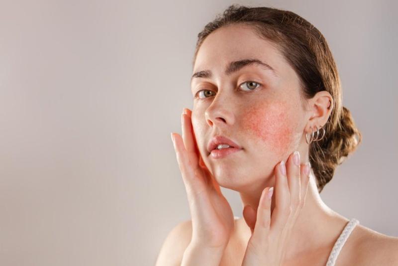 Top 5 Phòng Khám Trị Chàm Bớt, Sắc Tố Da Uy Tín Hàng Đầu TPHCM