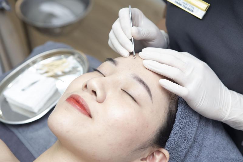 Top 10 Spa trị mụn tại Đồng Nai: uy tín & hiệu quả nhất