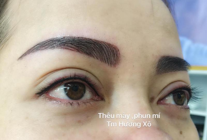 THẨM MỸ HƯỜNG XÔ