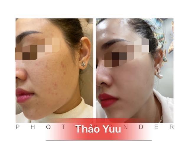 Thảo Yuu beauty & spa