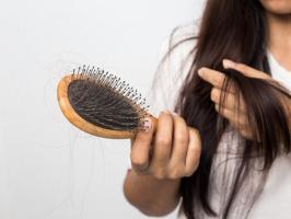 Sản phẩm trị rụng tóc hiệu quả nhất