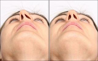 Giải đáp: các dáng mũi bị cấm kỵ trong phong thủy – nên tránh dáng nào?