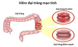 Bác sĩ khám chữa bệnh Đại tràng giỏi nhất ở Hà Nội