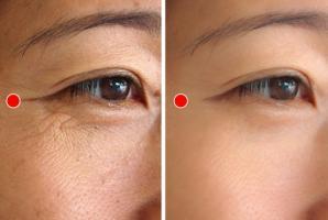 Bài tập 1 phút của người Nhật giúp ngăn ngừa và xóa nếp nhăn quanh mắt cực kì hiệu quả