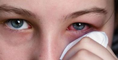 Bài thuốc dân gian hiệu quả nhất trị đau mắt đỏ