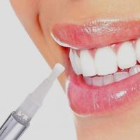 Bút tẩy trắng răng hiệu quả nhất cho răng ố vàng