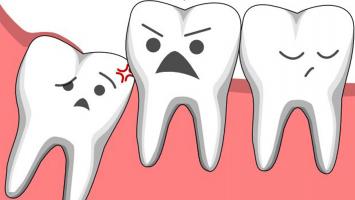 Cách đơn giản làm giảm đau khi mọc răng khôn hiệu quả nhất