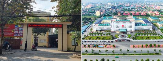 Địa chỉ xóa nốt ruồi ở Vinh Nghệ An: an toàn, uy tín