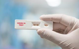 Điểm test PCR/test nhanh Covid-19 uy tín nhất tại Đà Nẵng