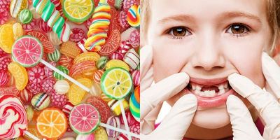 Thực phẩm phổ biến dễ gây sâu răng cho bạn nhất