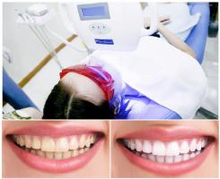 Nha khoa tẩy trắng răng tốt nhất tại quận Hai Bà Trưng, Hà Nội