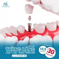 địa chỉ trồng  răng implant uy tín nhất quận Thanh Xuân, Hà Nội