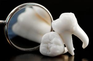 Top 6 Nha khoa nhổ răng khôn uy tín nhất tại Quận 1, TP. HCM