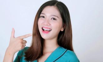 Nha khoa niềng răng mắc cài sứ dây trong uy tín nhất tỉnh Lâm Đồng