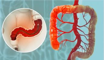 Phòng khám nội soi tiêu hoá tại Hải Phòng uy tín nhất