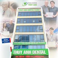 Review Nha Khoa Thùy Anh có tốt không? Chất lượng ra sao?