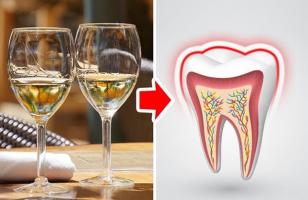 Thực phẩm gây hại nghiêm trọng cho răng của bạn