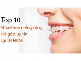 Nha khoa niềng răng trả góp uy tín nhất TP. HCM