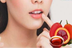Cách trị thâm môi tại nhà hiệu quả và đơn giản nhất