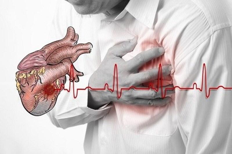 Nhồi máu cơ tim là gì?