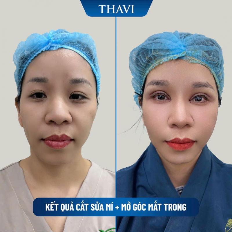 Viện Thẩm Mỹ Quốc Tế Thavi