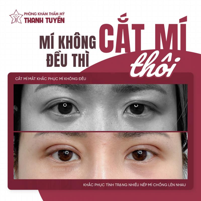 Thẩm Mỹ THANH TUYỀN